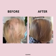 GLOWWA HAIR FOOD - 3 MONTH SUPPLY