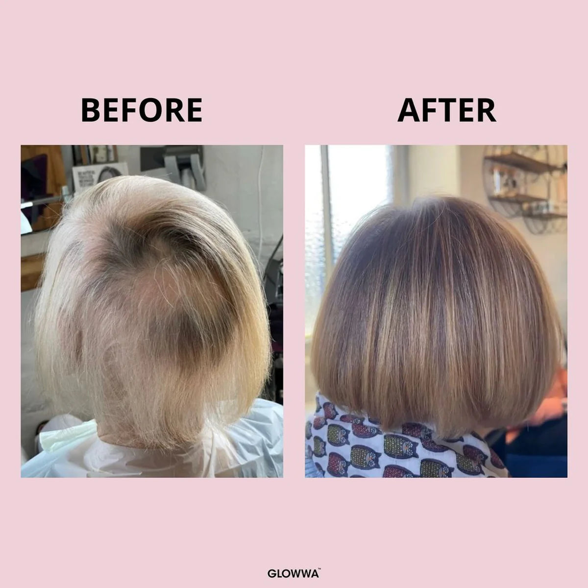 GLOWWA HAIR FOOD - HAIR VITAMINS, 1 MONTH SUPPLY